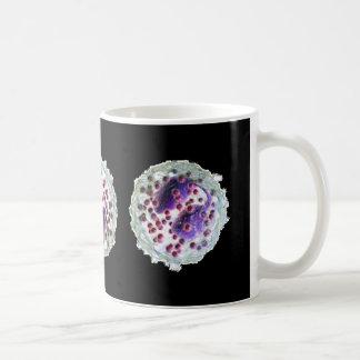 Caneca de café - Eosinophilia