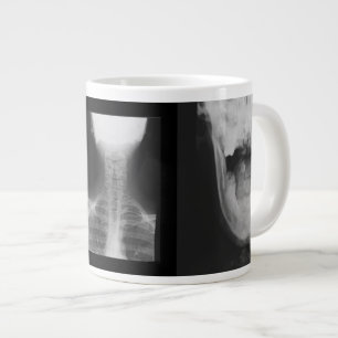 Caneca De Café Grande Raios X 3