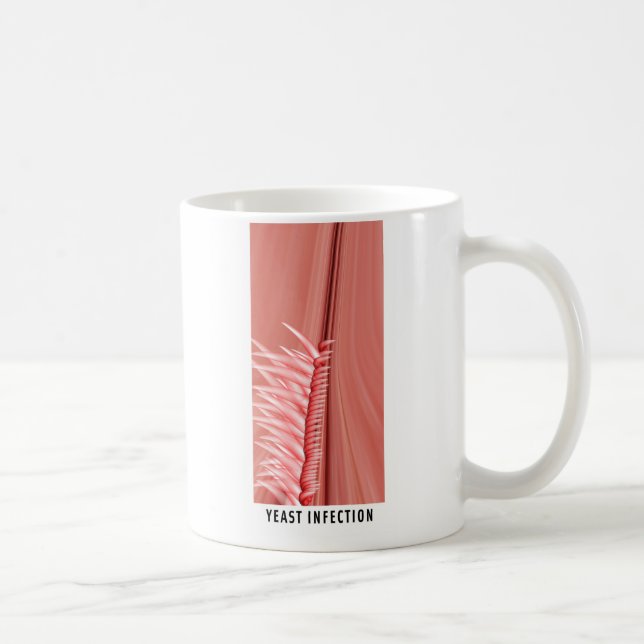 Caneca De Café Infecção de fermento (Direita)