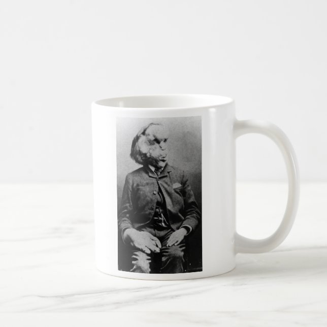 Caneca De Café Joseph "John" Merrick Elephant Man desde 1889 (Direita)