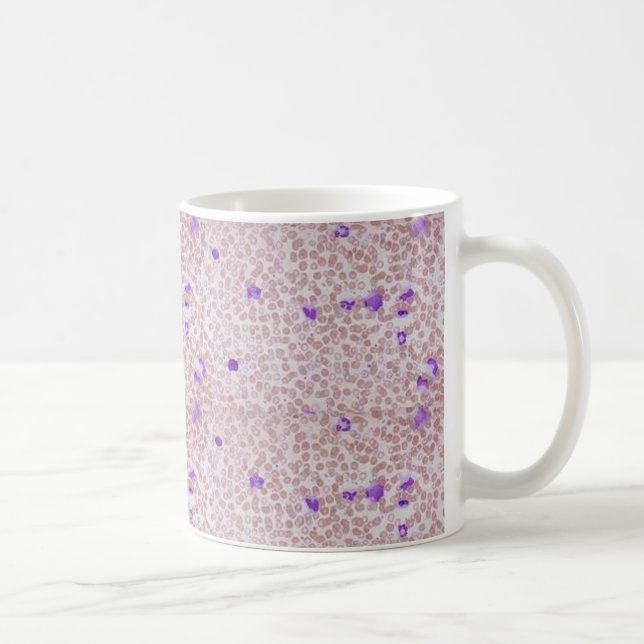 Caneca de café - leucemia mielóide crônica (CML) (Direita)