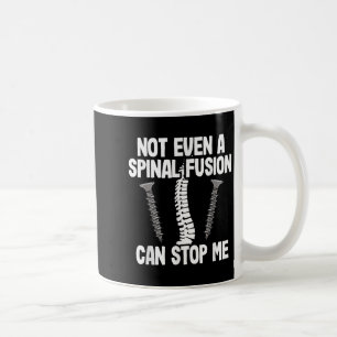 Caneca De Café Nem Mesmo Uma Fusão Snal Pode Me Parar Cirurgia Na