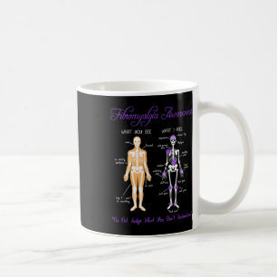 Caneca De Café O Que Você Vê O Que Eu Sinto Fibromialgia Awa De E