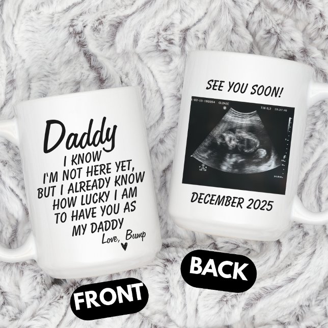 Caneca De Café Personalized Sonogram Photo, Ultrasound Photo Baby (Criador carregado)