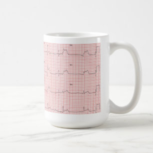 Caneca de ECG