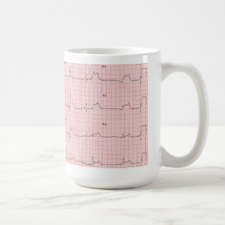 Caneca de ECG