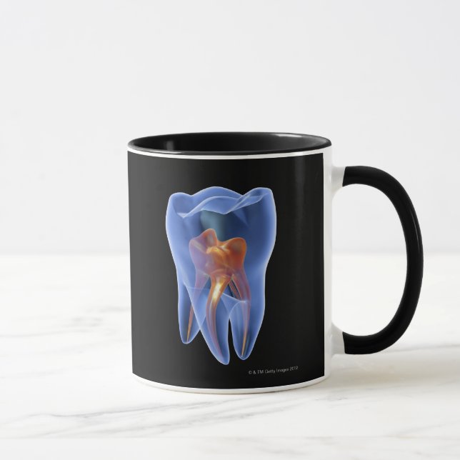 Caneca Dente, secção transversal transparente de um molar (Direita)