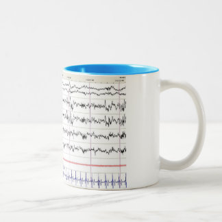 Caneca do sono EEG - sono do palco 2