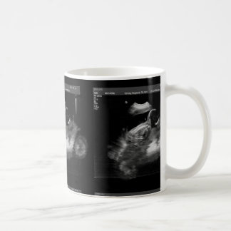 Caneca do Sonogram da motocicleta