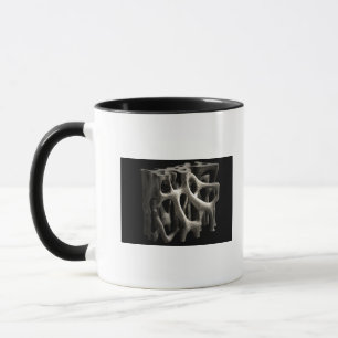 Caneca Estrutura de um osso com osteoporose