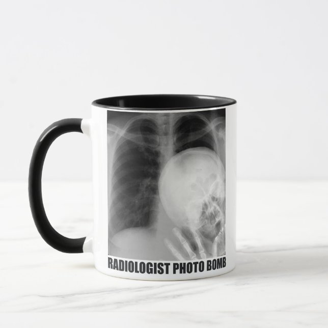 CANECA FOTO RADIÓLOGA BOMBA (Esquerda)
