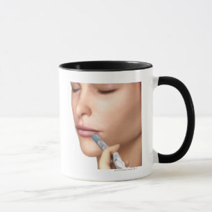 Caneca Injeções de Botox