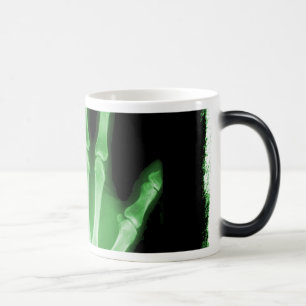 Caneca Mágica Mão verde do esqueleto do raio X