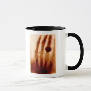 Caneca O primeiro Raio X, 1901, fotografia