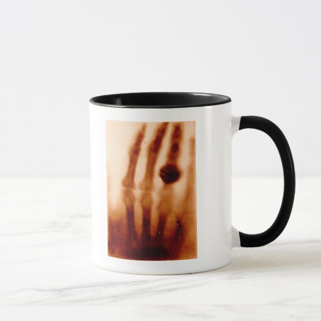 Caneca O primeiro Raio X, 1901, fotografia (Direita)