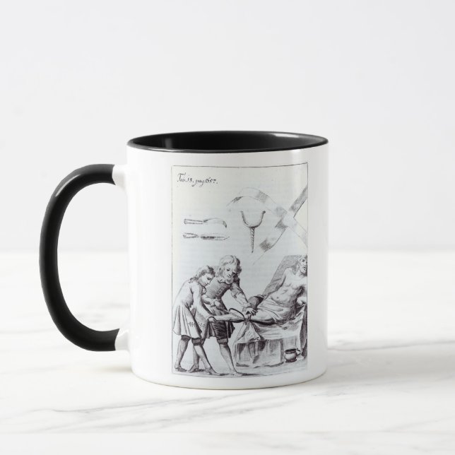 Caneca Operação cirúrgica para amputar um pé (Esquerda)