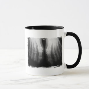Caneca Preto & branco de esqueleto humanos de ossos dos