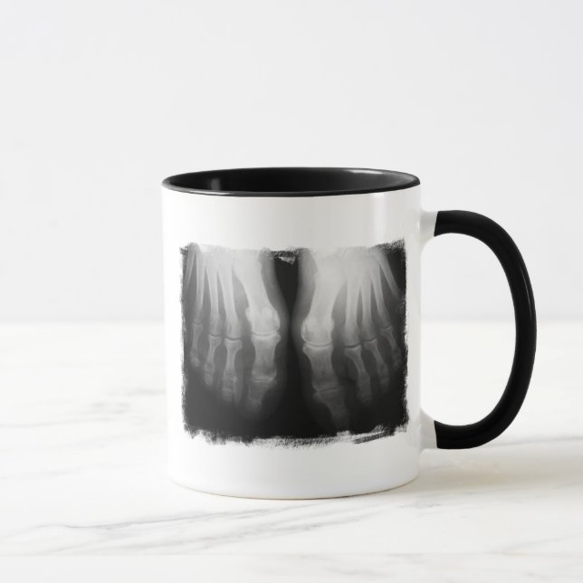 Caneca Preto & branco de esqueleto humanos de ossos dos (Direita)