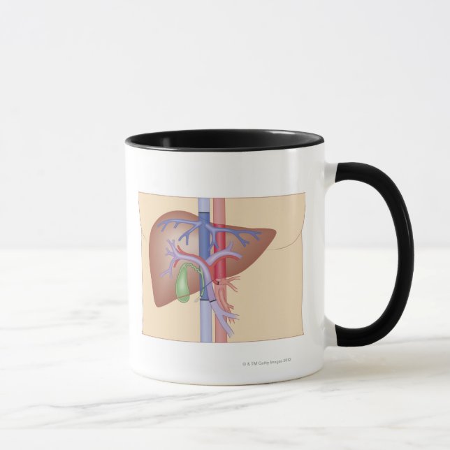 Caneca Procedimento da transplantação do fígado (Direita)