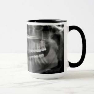 Caneca Radiografia Panoramica