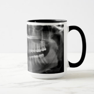 Caneca Radiografia Panoramica