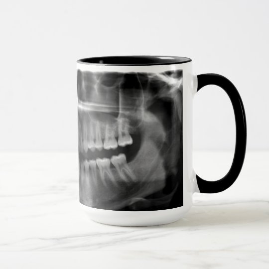 Caneca Radiografia Panoramica