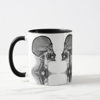 Caneca Radiologica