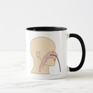 Caneca Rhinoscopy anterior