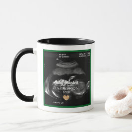 Caneca Sonograma Bebê chegando Logo Anúncio para o tio