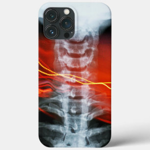 Capa de telefone Trabalho de arte digital de raios