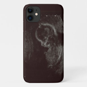 Capa Para iPhone 11 Foto Ultrassônica De Seus Bebês