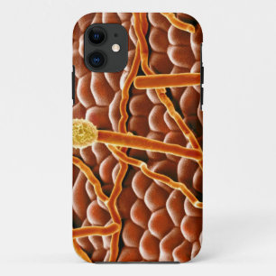 Capa Para iPhone 11 Fungo do oídio pulverulento na poinsétia