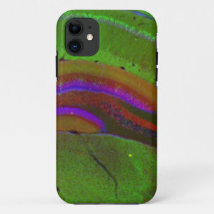 Capa Para iPhone 11 Neurônios de Hippocampal