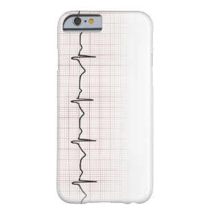 Capa Barely There Para iPhone 6 Pulsação do coração no papel de gráfico, pulso de