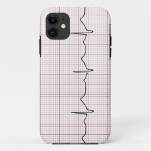 Capa Para iPhone Da Case-Mate Pulsação do coração no papel de gráfico, puls