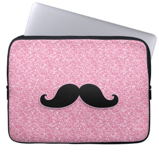 CAPA PARA NOTEBOOK BRILHO PRETO FEMININO DO ROSA DO BIGODE IMPRESSO