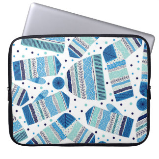Capa Para Notebook Calçado: Padrão Invisível e Perfeito de Olho.