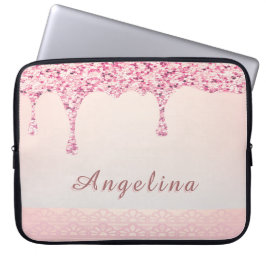 Capa Para Notebook Elegante Rosa Glam Glitter Gotejamento Renda Chá d