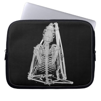 Capa Para Notebook Esqueleto de Morcego Gótico Sinistro