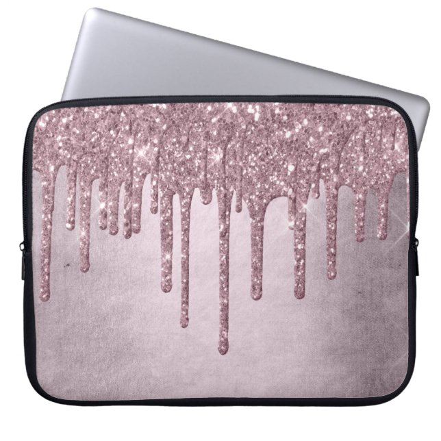 Capa Para Notebook Glitter Girly | Dusty Mauve Shimmer Rosa (Frente)