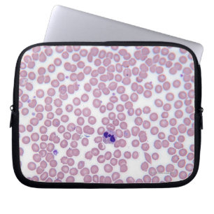 Capa Para Notebook Glóbulos Malarial