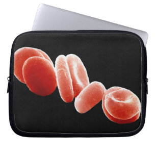 Capa Para Notebook Glóbulos vermelhos
