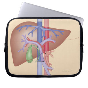 Capa Para Notebook Procedimento da transplantação do fígado