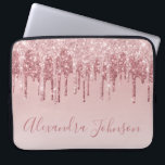 Capa Para Notebook Rosa Rosa Rosa Rosa Rosa Ouro, Brilhante Monograma<br><div class="desc">Cor-de-rosa-pincelado - Rosa Dourada,  brilho de popa fina e cinza Elegante monograma,  caixa de Laptop ou Capa para computador giro-catita. Este caso pode ser personalizado para incluir o nome do script de assinatura.</div>