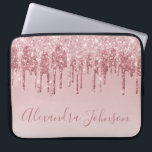Capa Para Notebook Rosa Rosa Rosa Rosa Rosa Ouro, Brilhante Monograma<br><div class="desc">Cor-de-rosa-pincelado - Rosa Dourada,  brilho de popa fina e cinza Elegante monograma,  caixa de Laptop ou Capa para computador giro-catita. Este caso pode ser personalizado para incluir o nome do script de assinatura.</div>