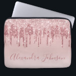 Capa Para Notebook Rosa Rosa Rosa Rosa Rosa Ouro, Brilhante Monograma<br><div class="desc">Cor-de-rosa-pincelado - Rosa Dourada,  brilho de popa fina e cinza Elegante monograma,  caixa de Laptop ou Capa para computador giro-catita. Este caso pode ser personalizado para incluir o nome do script de assinatura.</div>