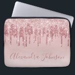 Capa Para Notebook Rosa Rosa Rosa Rosa Rosa Ouro, Brilhante Monograma<br><div class="desc">Cor-de-rosa-pincelado - Rosa Dourada,  brilho de popa fina e cinza Elegante monograma,  caixa de Laptop ou Capa para computador giro-catita. Este caso pode ser personalizado para incluir o nome do script de assinatura.</div>