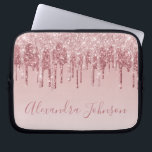 Capa Para Notebook Rosa Rosa Rosa Rosa Rosa Ouro, Brilhante Monograma<br><div class="desc">Cor-de-rosa-pincelado - Rosa Dourada,  brilho de popa fina e cinza Elegante monograma,  caixa de Laptop ou Capa para computador giro-catita. Este caso pode ser personalizado para incluir o nome do script de assinatura.</div>