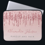 Capa Para Notebook Rosa Rosa Rosa Rosa Rosa Ouro, Brilhante Monograma<br><div class="desc">Cor-de-rosa-azul - Rosa Dourado,  com brilho e brilho no cabelo profissional de negócios do monograma Elegante e cinta-se Promocional de beleza Laptop computador ou Capa. Este caso pode ser personalizado para incluir o nome do script de assinatura e o título do cargo ou posição.</div>