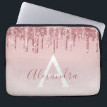 Capa Para Notebook Rosa Rosa Rosa Rosa Rosa Ouro, Brilhante Monograma<br><div class="desc">Cor-de-rosa-pincelado - Rosa Dourada,  brilho de popa fina e cinza Elegante monograma,  caixa de Laptop ou Capa para computador giro-catita. Este caso pode ser personalizado para incluir o nome do script de assinatura.</div>